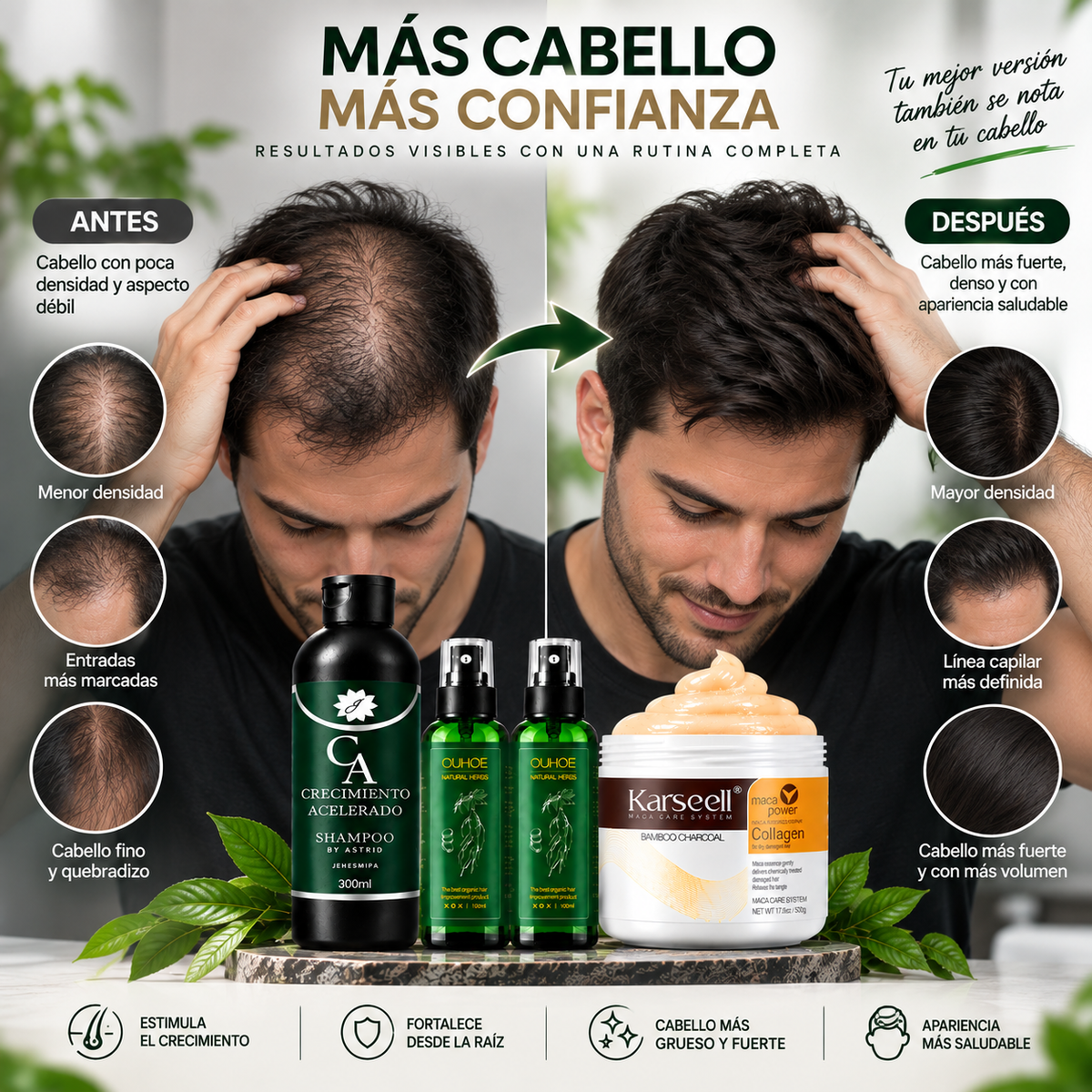 Combo Capilar Anticaída Premium - 2 OUHOE + 1 Crecimiento Acelerado + 1 Karseell