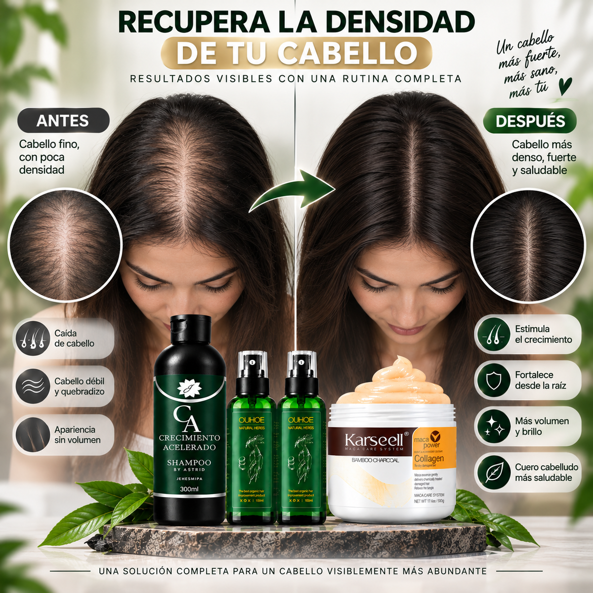 Combo Capilar Anticaída Premium - 2 OUHOE + 1 Crecimiento Acelerado + 1 Karseell